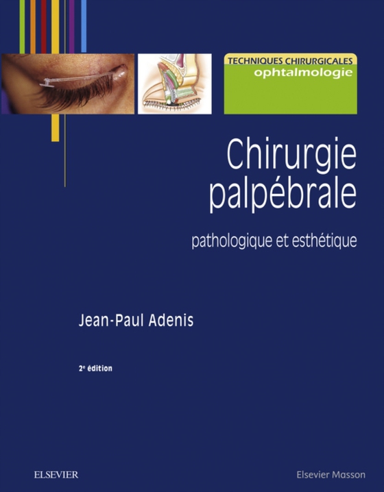 Chirurgie palpébrale