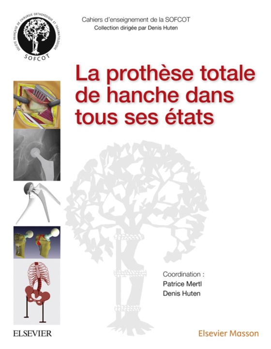 La prothèse totale de hanche dans tous ses états (e-bog) af Mertl, Patrice