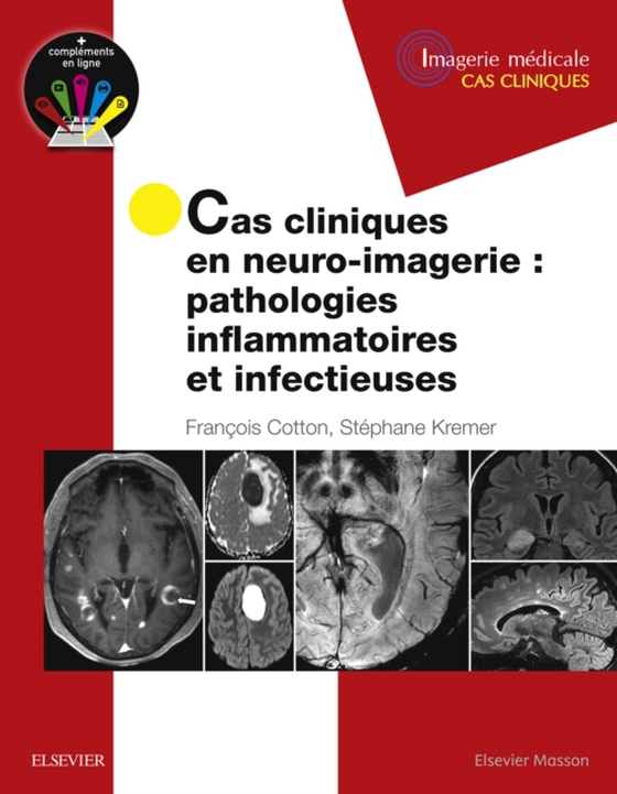 Cas cliniques en neuro-imagerie : pathologies inflammatoires et infectieuses (e-bog) af Kremer, Stephane