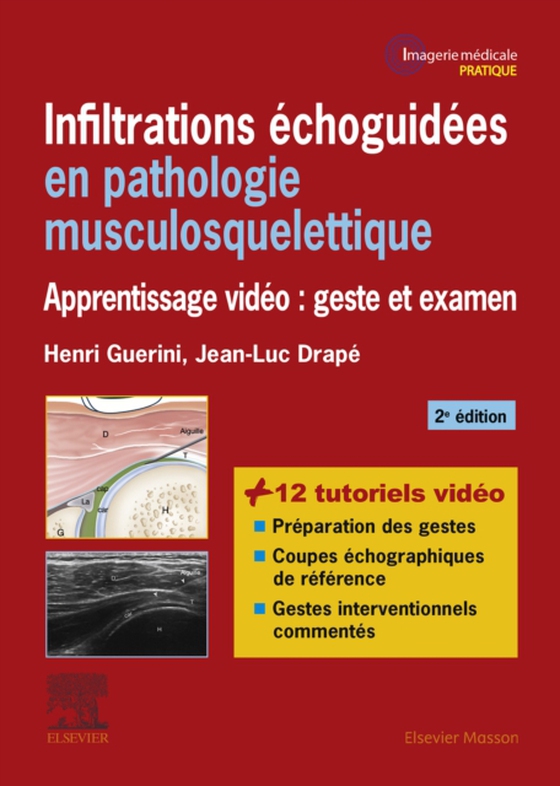 Infiltrations échoguidées en pathologie musculosquelettique (e-bog) af Guerini, Henri