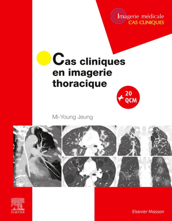 Cas cliniques en imagerie thoracique (e-bog) af Jeung, Mi-Young