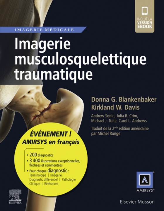 Imagerie musculosquelettique traumatique (e-bog) af Davis, Kirkland W.