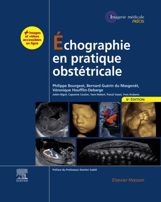 Échographie en pratique obstétricale