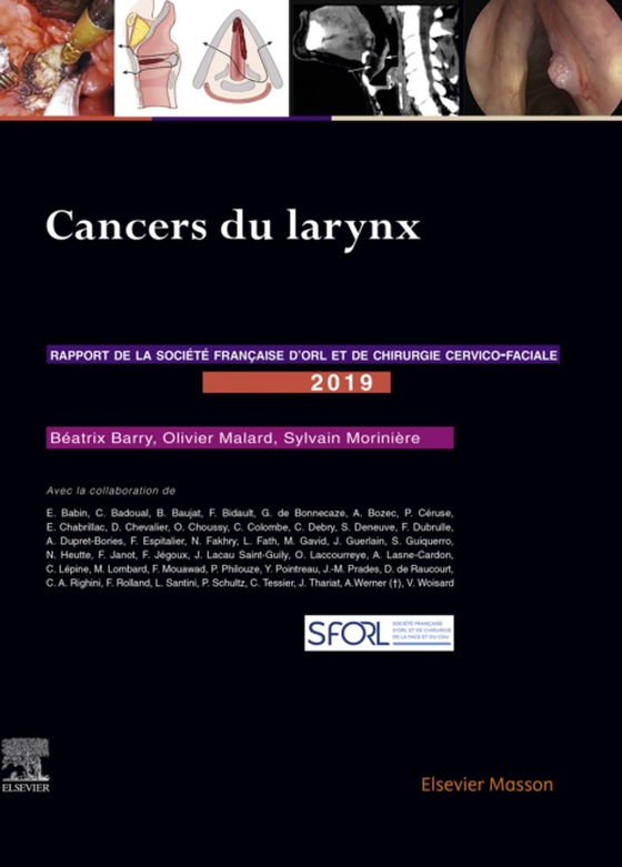 Cancers du larynx (e-bog) af Moriniere, Sylvain