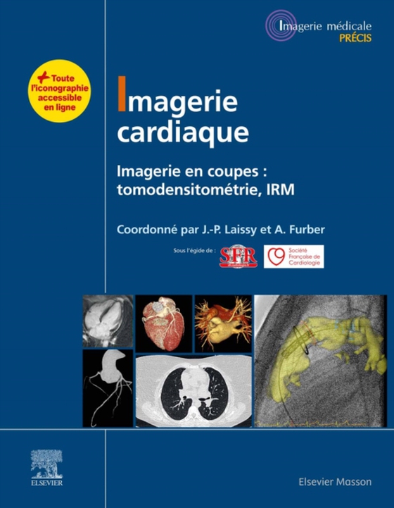 Imagerie cardiaque (e-bog) af FUMAT, Carole