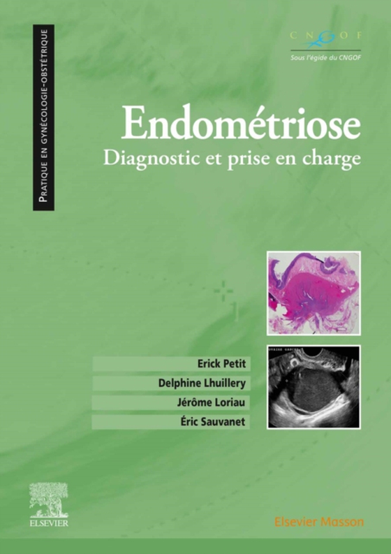 Endométriose