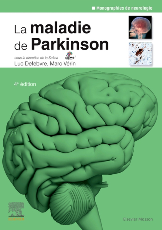 La maladie de Parkinson (e-bog) af Verin, Marc