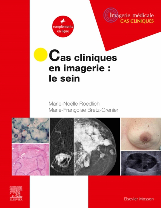 Cas cliniques en imagerie : le sein CAMPUS (e-bog) af Roedlich, Marie-Noelle