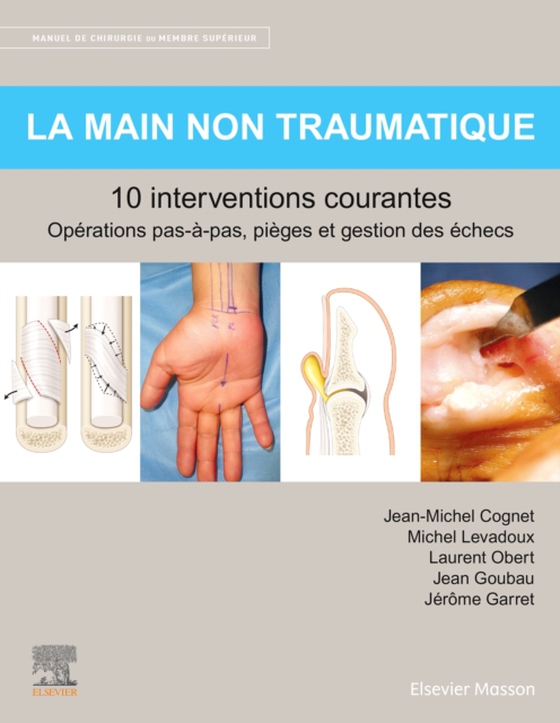 La main non traumatique 10 interventions courantes (e-bog) af Garret, Jerome