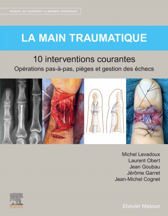 La main traumatique 10 interventions courantes (e-bog) af Cognet, Jean-Michel