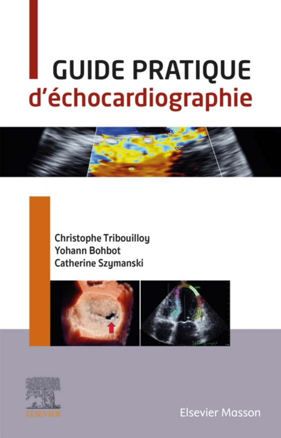 Guide pratique d'échocardiographie (e-bog) af Bohbot, Yohann