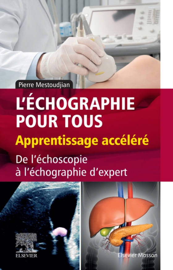 L’échographie pour tous : apprentissage accéléré (e-bog) af Mestoudjian, Pierre