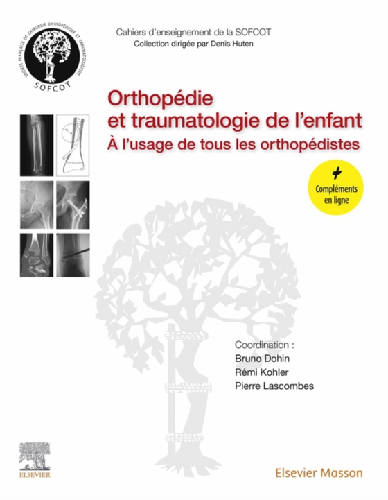 Orthopédie et traumatologie de l'enfant