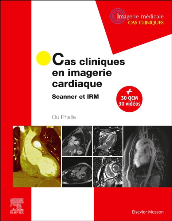 Cas cliniques en imagerie cardiaque (e-bog) af Ou, Phalla