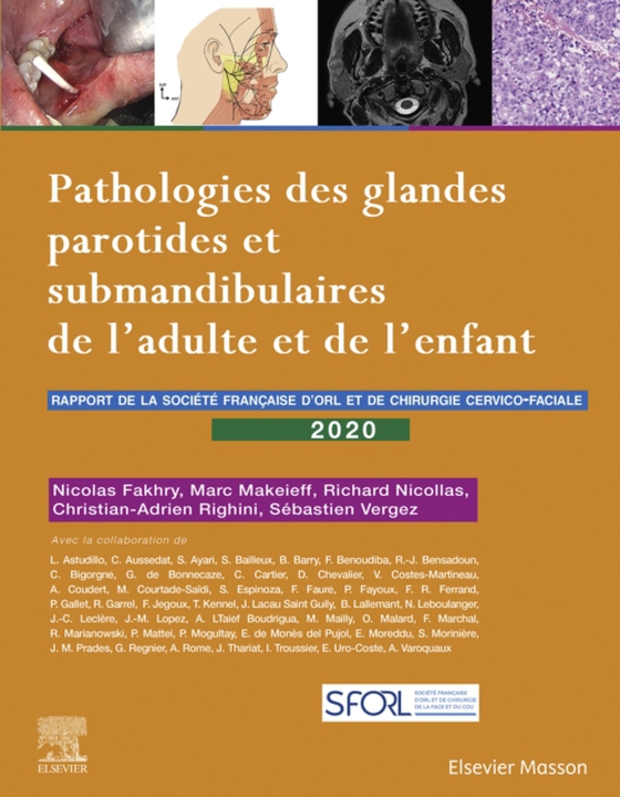 Pathologies des glandes parotides et submandibulaires de l'adulte et de l'enfant