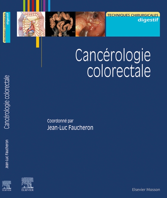 Cancérologie colorectale