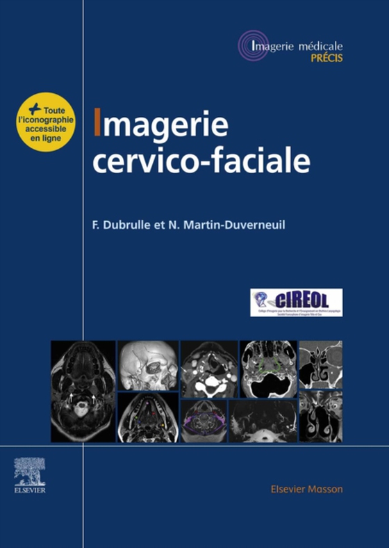 Imagerie cervicofaciale