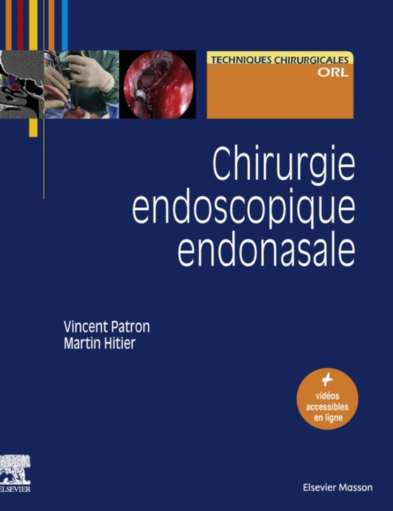 Chirurgie endoscopique endonasale