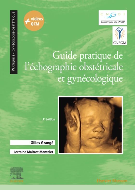 Guide pratique de l'échographie obstétricale et gynécologique - CAMPUS (e-bog) af Grange, Gilles