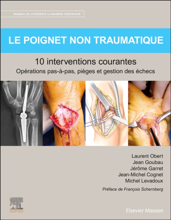 Le poignet non traumatique 10 interventions courantes (e-bog) af Obert, Laurent