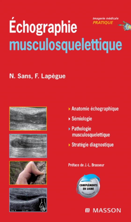 Echographie musculosquelettique (e-bog) af Lapegue, Franck