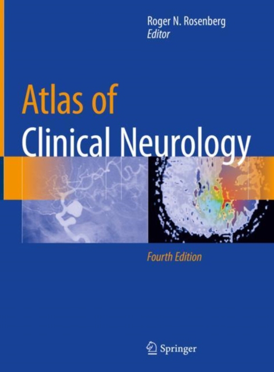 Atlas of Clinical Neurology