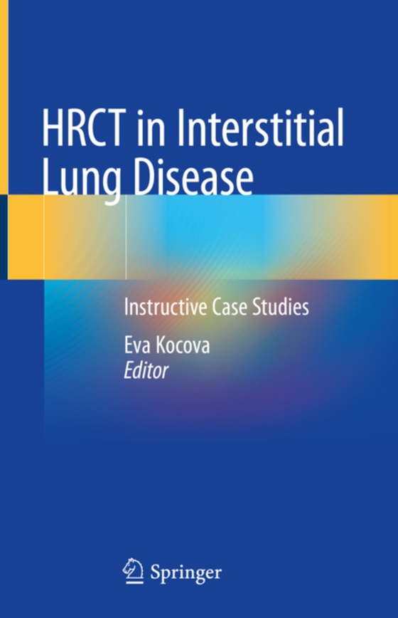 HRCT in Interstitial Lung Disease (e-bog) af -