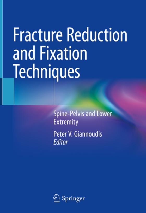 Fracture Reduction and Fixation Techniques (e-bog) af -