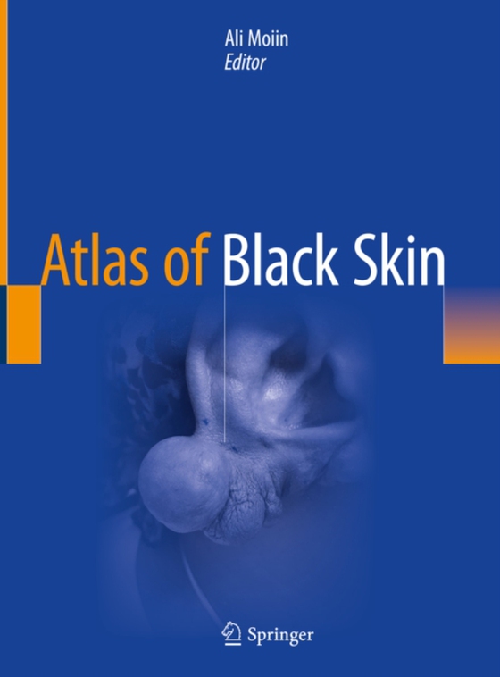 Atlas of Black Skin (e-bog) af -