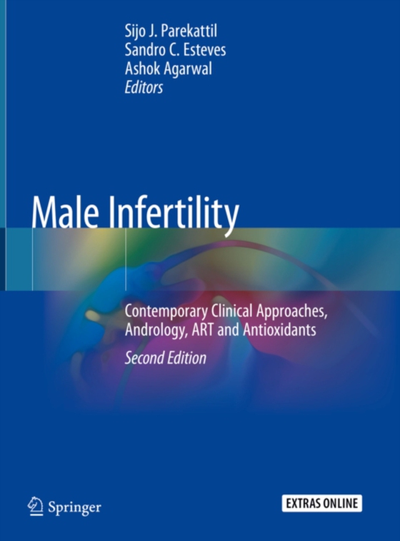 Male Infertility (e-bog) af -