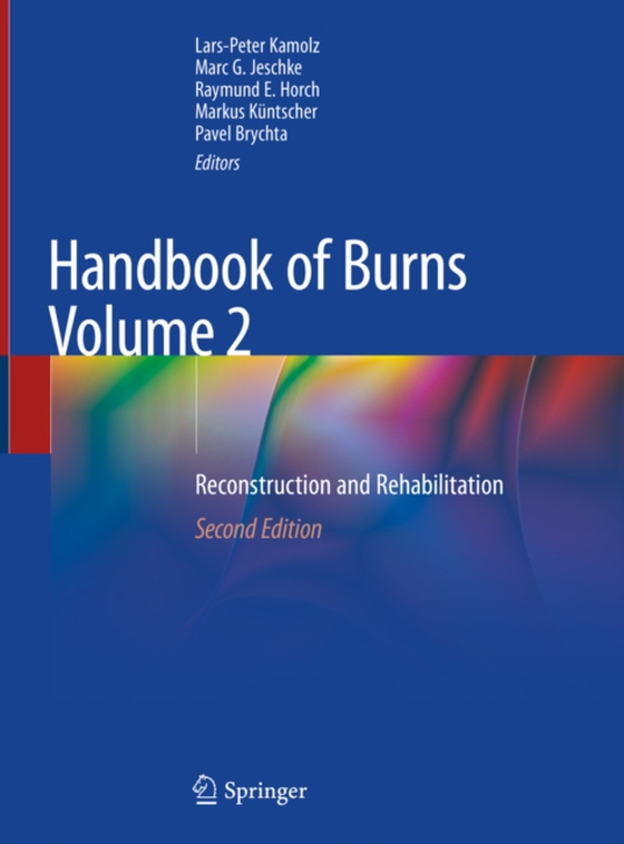 Handbook of Burns Volume 2 (e-bog) af -