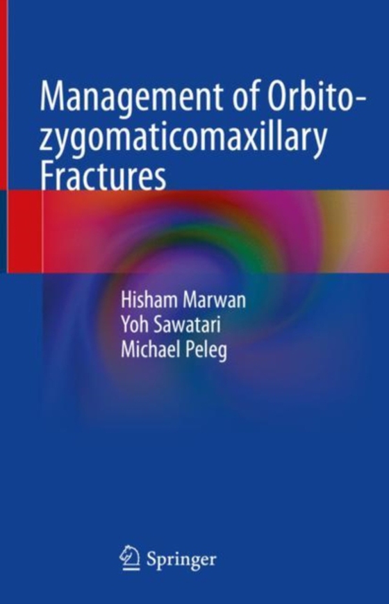 Management of Orbito-zygomaticomaxillary Fractures (e-bog) af Peleg, Michael