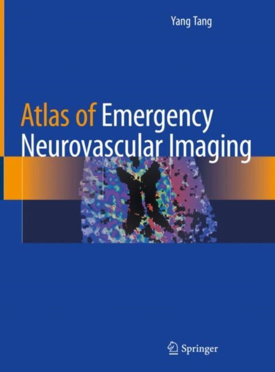 Atlas of Emergency Neurovascular Imaging (e-bog) af Tang, Yang