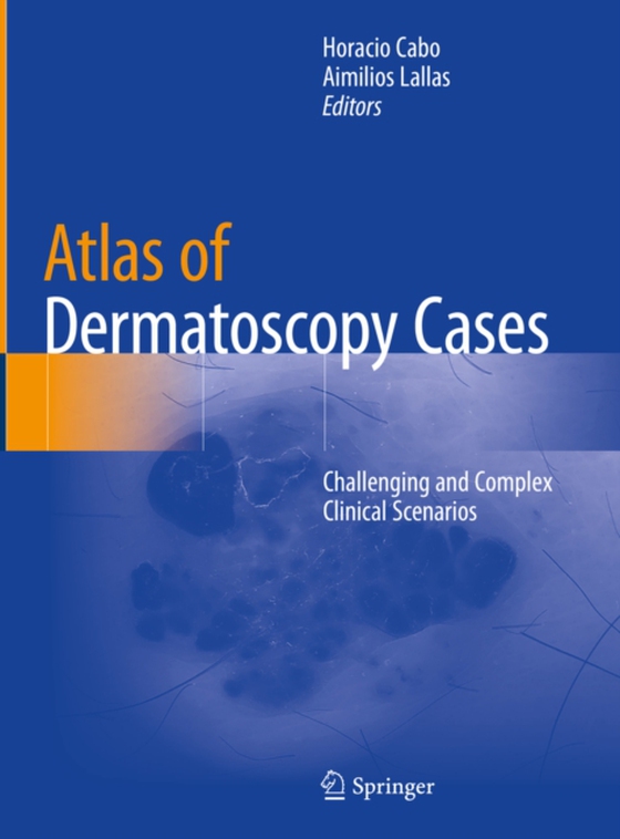  Atlas of Dermatoscopy Cases (e-bog) af -