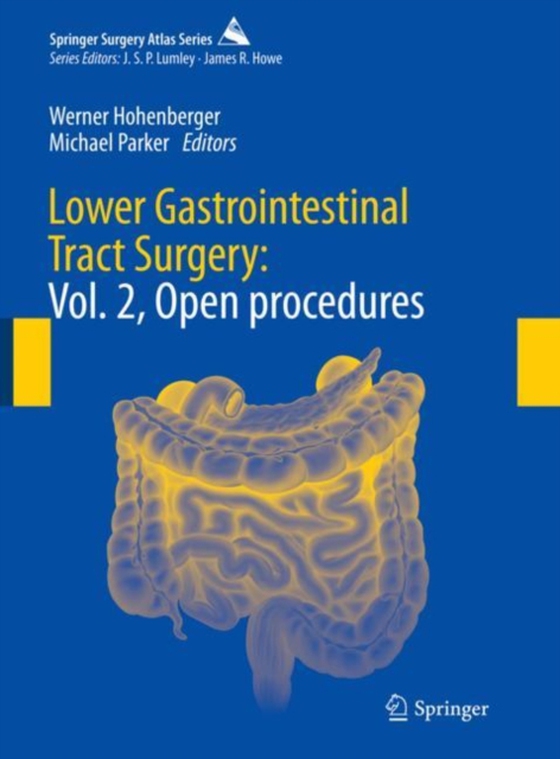 Lower Gastrointestinal Tract Surgery (e-bog) af -