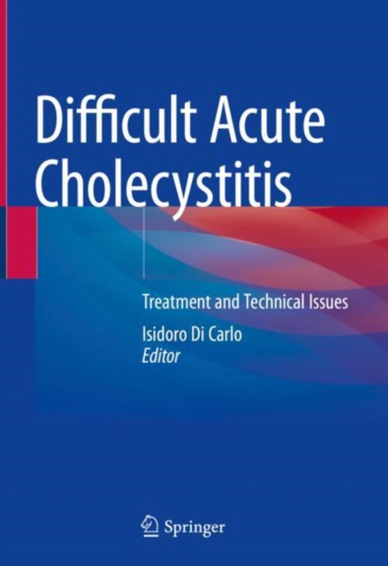 Difficult Acute Cholecystitis (e-bog) af -