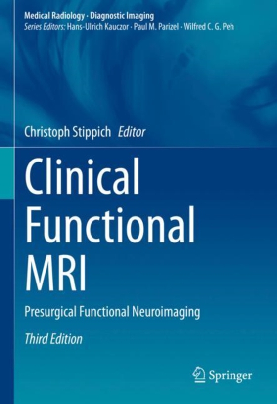 Clinical Functional MRI (e-bog) af -