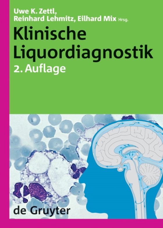 Klinische Liquordiagnostik (e-bog) af -