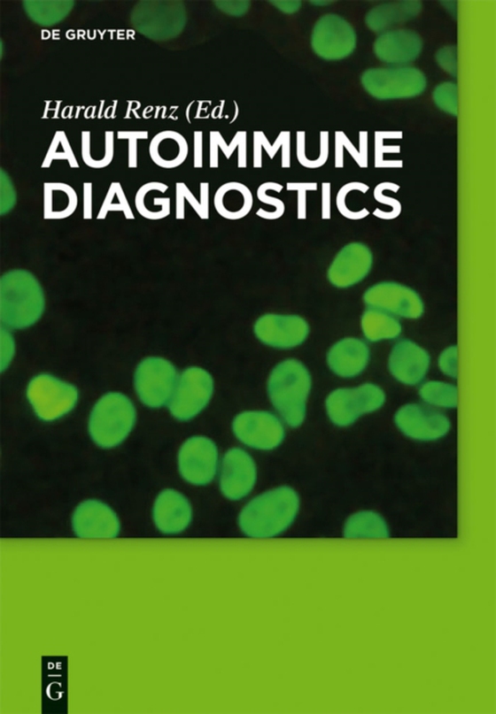 Autoimmune Diagnostics (e-bog) af -