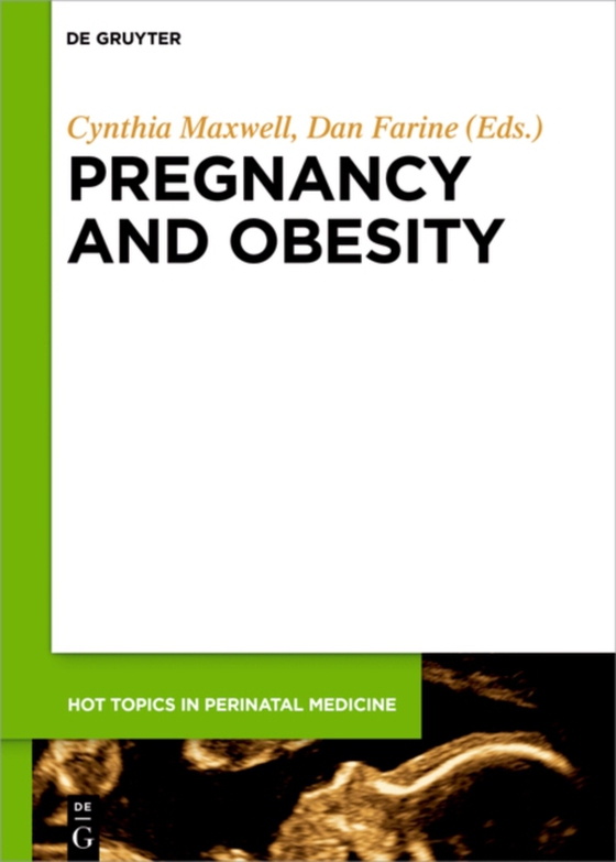 Pregnancy and Obesity (e-bog) af -