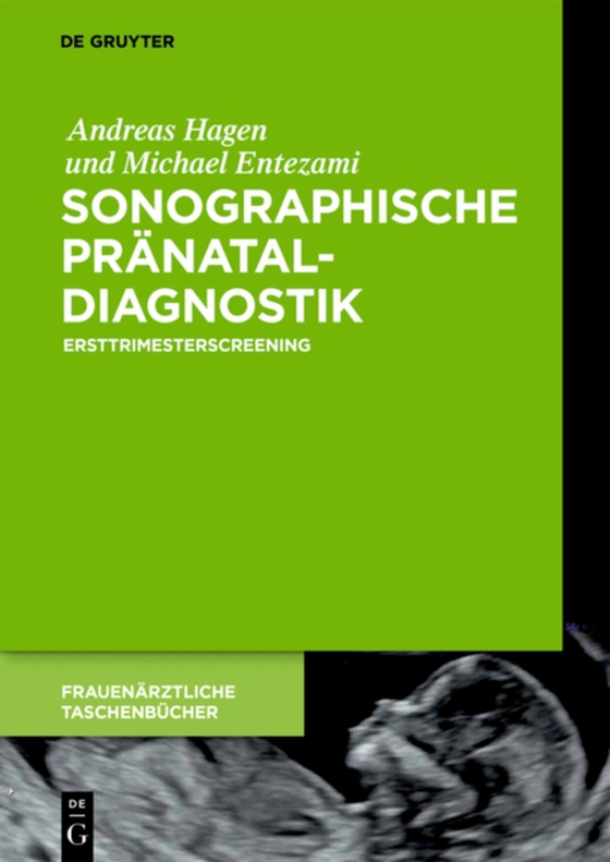 Sonographische Pränataldiagnostik (e-bog) af Entezami, Michael