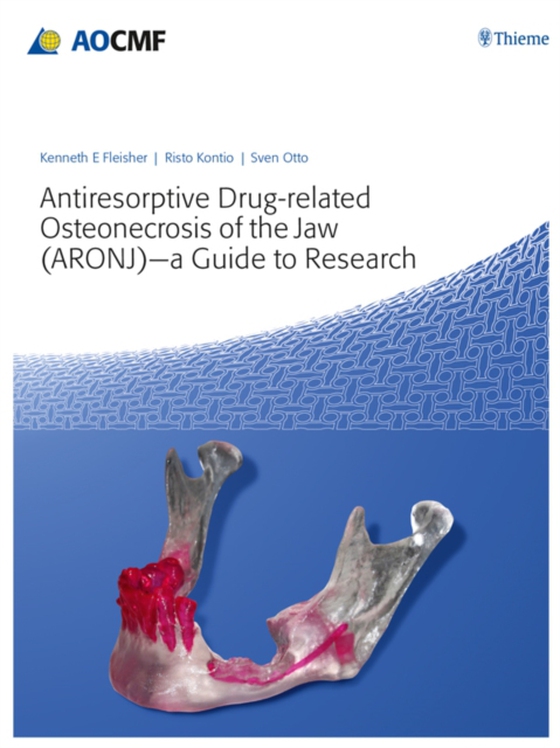 Antiresorptive Drug-Related Osteonecrosis of the Jaw (ARONJ) - A Guide to Research (e-bog) af -