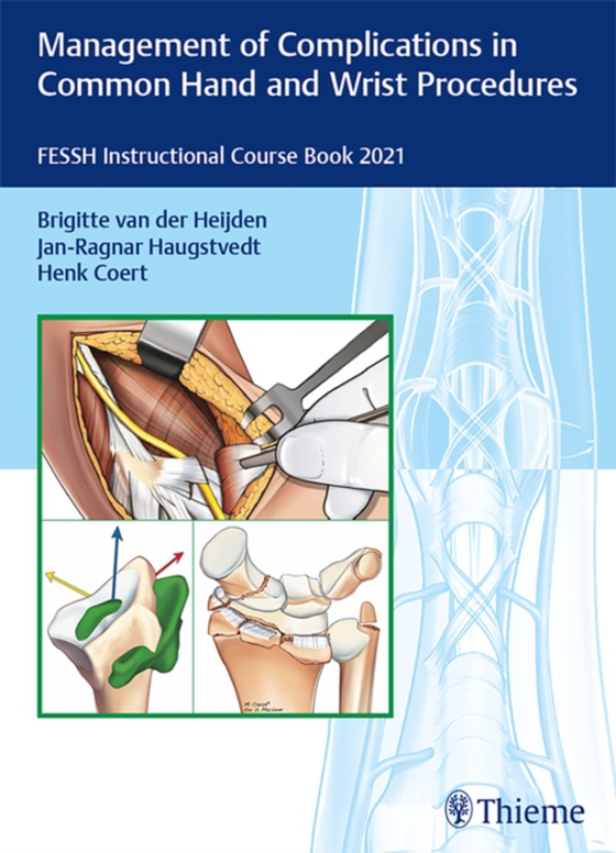 Management of Complications in Common Hand and Wrist Procedures