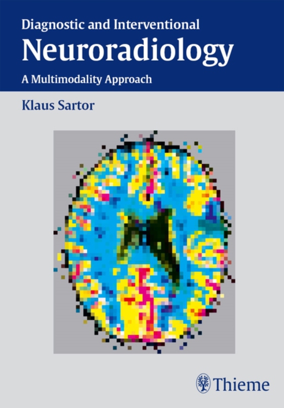 Diagnostic and Interventional Neuroradiology (e-bog) af Sartor, Klaus