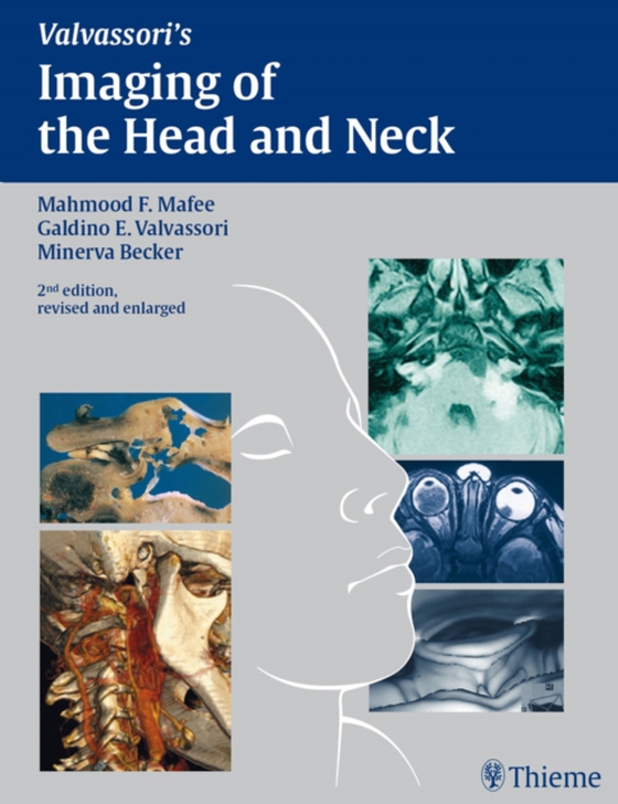 Imaging of the Head and Neck (e-bog) af Becker, Minerva