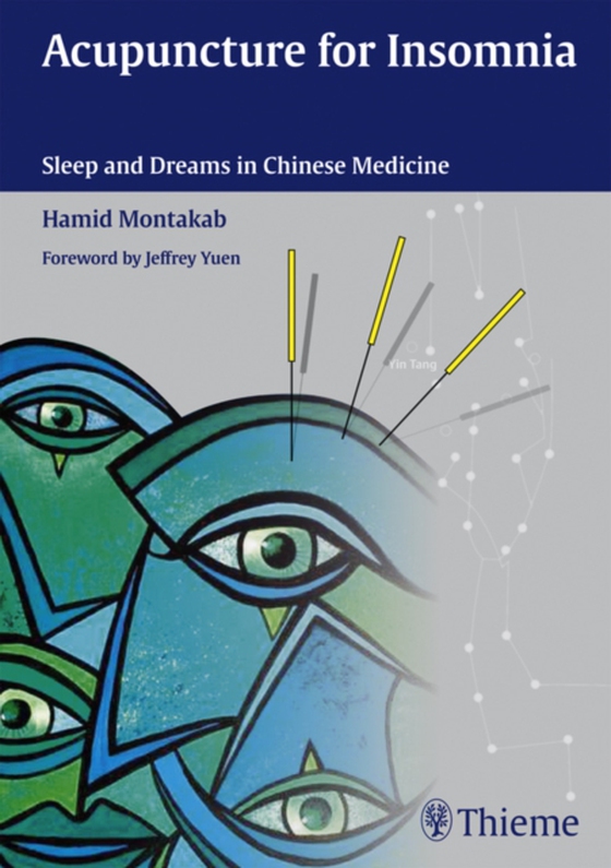 Acupuncture for Insomnia