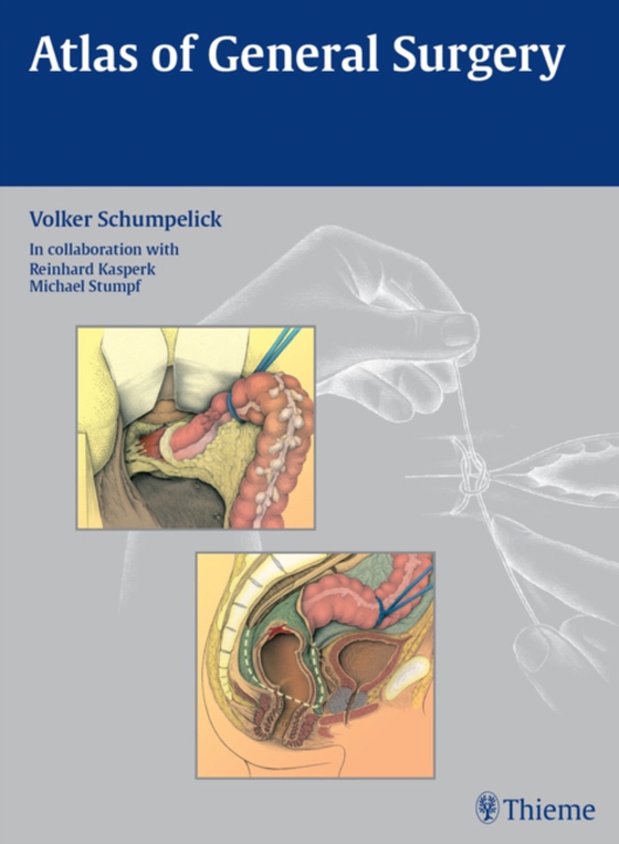 Atlas of General Surgery (e-bog) af Schumpelick, Volker