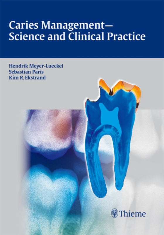 Caries Management - Science and Clinical Practice (e-bog) af -