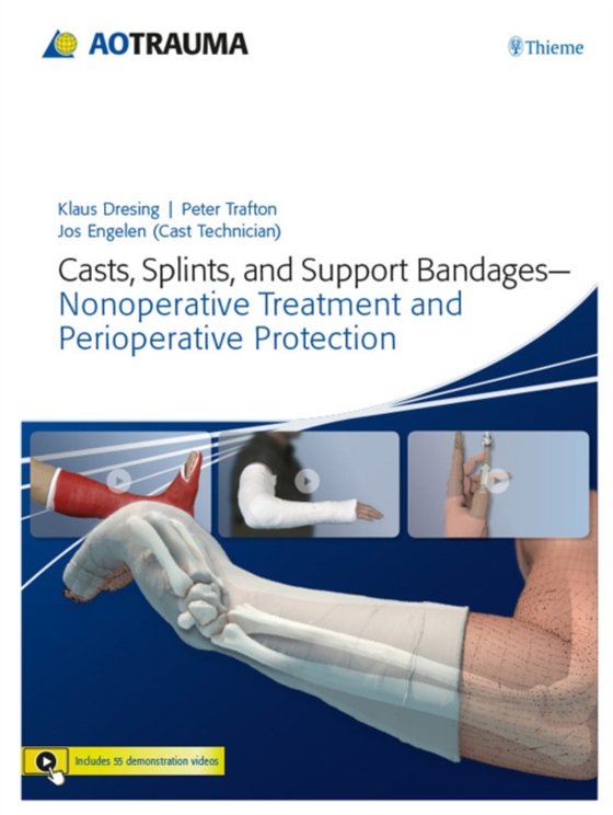 Casts, Splints, and Support Bandages