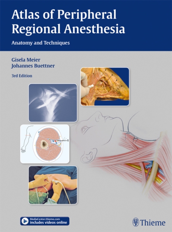 Atlas of Peripheral Regional Anesthesia (e-bog) af Buettner, Johannes